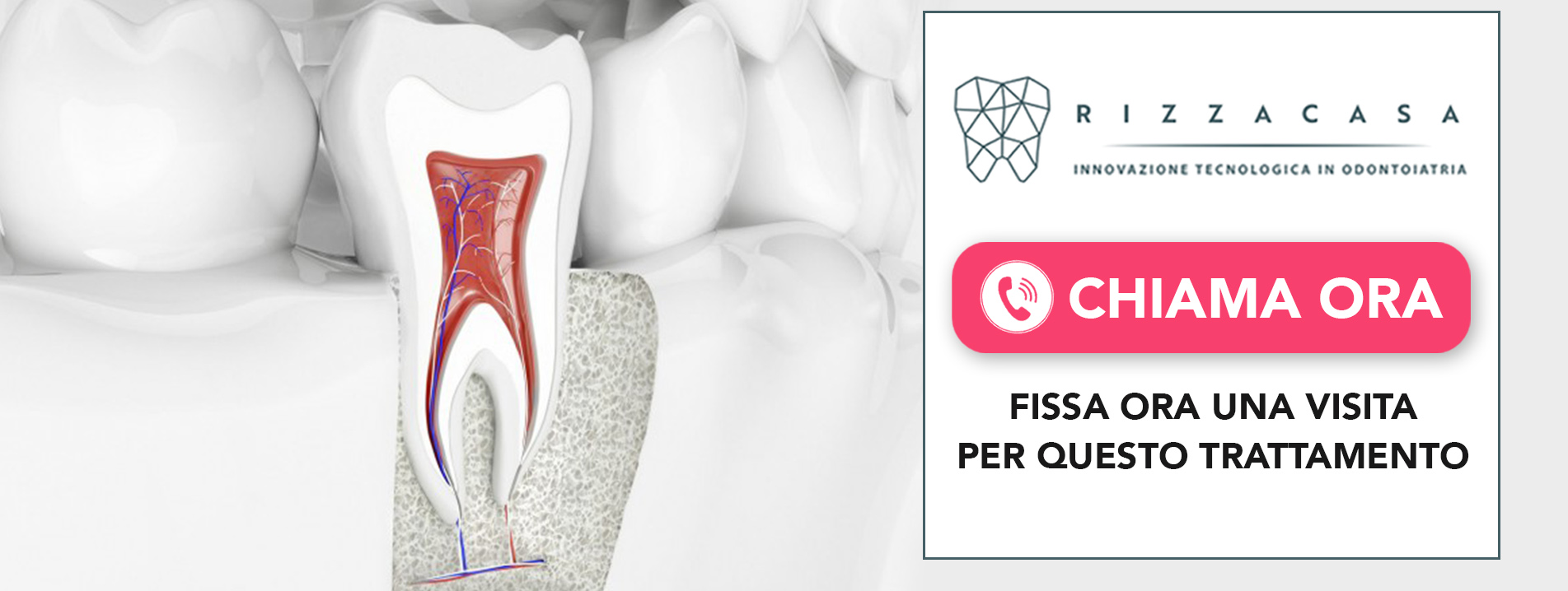 IL TRATTAMENTO DEL CASO ENDODONTICO COMPLESSO