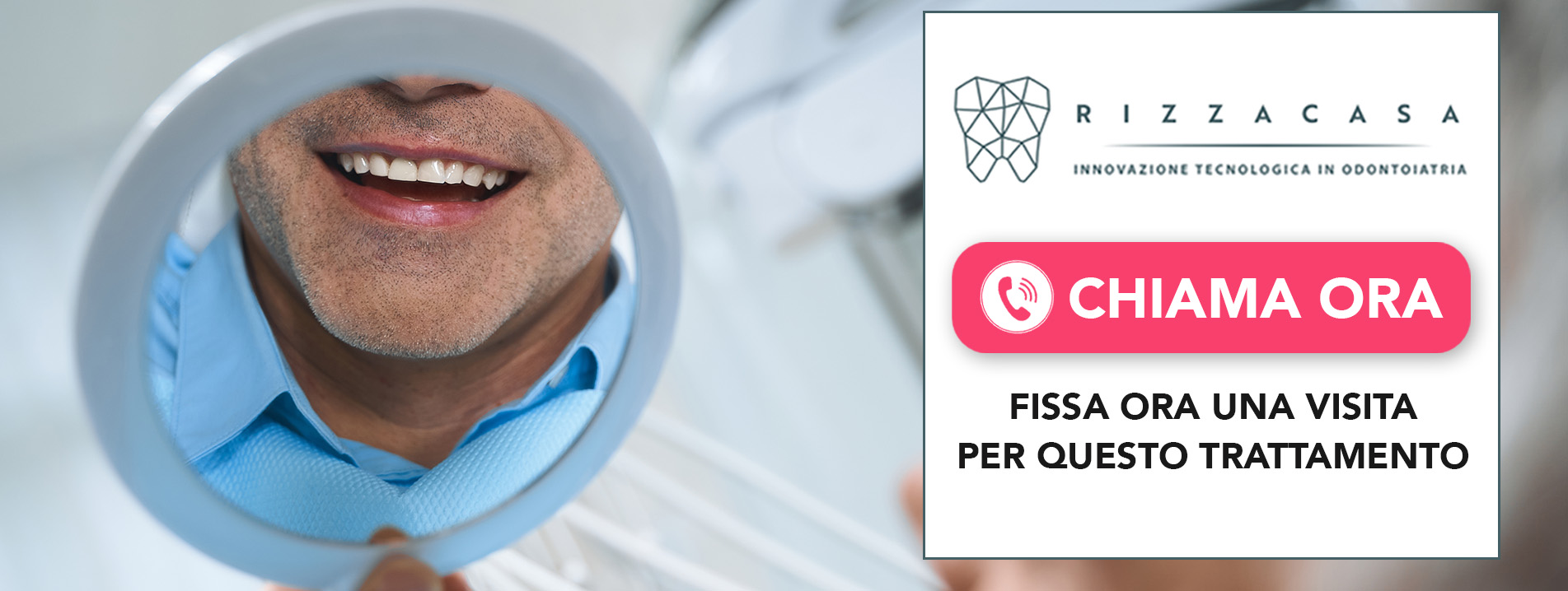 Faccette Estetiche Monza e Brianza - Studio Dentistico Rizzacasa